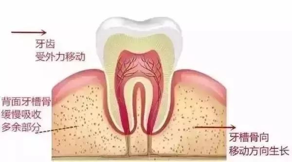 牙齿矫正原理.jpg