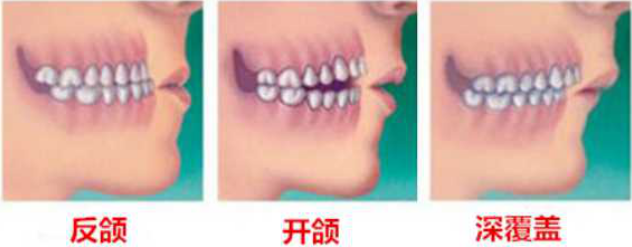 多种牙齿问题需要矫正.png