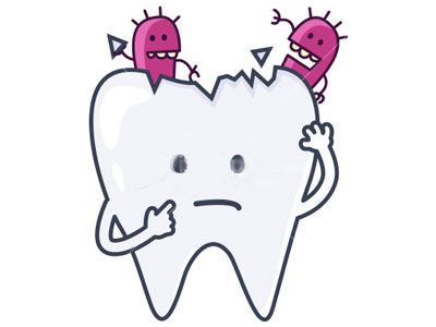 如何预防儿童蛀牙?